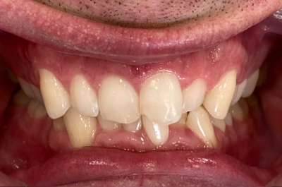 Before Sparkle Dental treatment