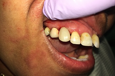 After Sparkle Dental treatment