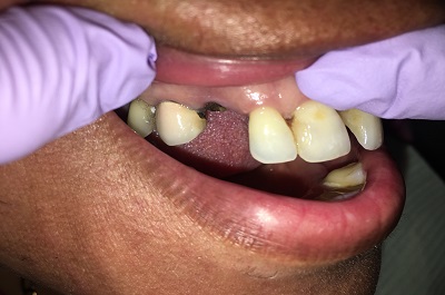 Before Sparkle Dental treatment