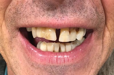 Before Sparkle Dental treatment