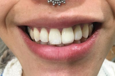 After Sparkle Dental treatment